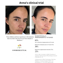 Load image into Gallery viewer, Vida Glow Radiance+ natural skin brightening supplement for flawless complexion. This is Anna&#39;s clinical trial. improvement in pigmentation and melasma
