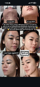 COLLEET Upgraded GLOW-LT+ - 💧 2x moisturising power
✨ 3x brighter, radiant glow
🛡️ 5x antioxidant protection
💪 5x collagen support